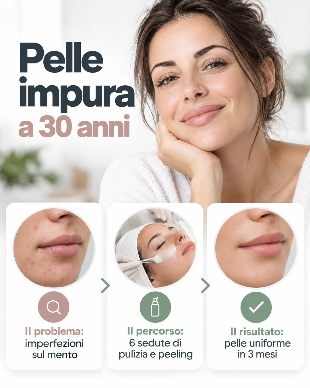pelle impura a 30 anni, il percorso in 3 mesi